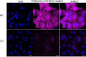 Immunocytochemical staining of HepG2 cells using Epidermal growth factor receptor antibody (ABIN7798478), 1:1,000), Top panel: wild-type (WT), Bottom panal: Adiponectin receptor 1 shRNA knockdown (KD).