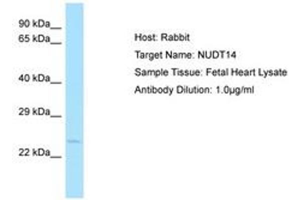 NUDT14 antibody  (AA 151-200)