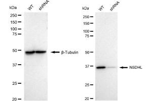 Western blotting analysis using NSDHL antibody (ABIN7799538).
