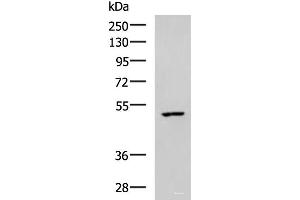 CKMT1 抗体