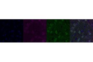 Immunohistochemistry (IHC) image for anti-Cholinergic Receptor, Nicotinic, alpha 6 (CHRNA6) antibody (ABIN7456066)