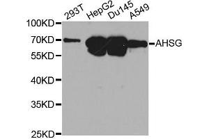 Western blot analysis of extracts of various cell lines, using AHSG antibody. (Fetuin A anticorps  (AA 19-300))