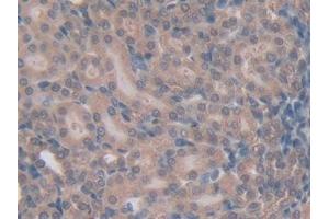 Detection of CXCL7 in Rat Kidney Tissue using Polyclonal Antibody to Chemokine (C-X-C motif) ligand 7 ( CXCL7) (CXCL7 anticorps  (AA 46-107))