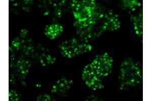 Image no. 14 for anti-Replication Protein A2, 32kDa (RPA2) antibody (ABIN1500736) (RPA2 anticorps)