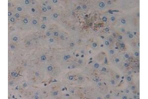 Detection of PSAP in Human Liver Tissue using Polyclonal Antibody to Prosaposin (PSAP)