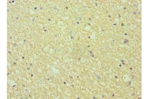 Immunohistochemistry of paraffin-embedded human brain tissue using ABIN7151874 at dilution of 1:100 (Ephrin A1 anticorps  (AA 19-182))