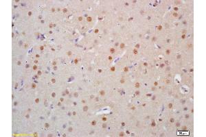 Formalin-fixed and paraffin embedded rat brain tissue labeled Anti-HSTF2/HSF2 Polyclonal Antibody, Unconjugated (ABIN686137) at 1:200, followed by conjugation to the secondary antibody and DAB staining (HSF2 anticorps  (AA 401-536))