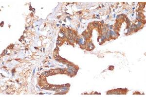 Immunohistochemistry of paraffin-embedded Human lung using HHLA2 Polyclonal Antibody at dilution of 1:100 (40x lens).