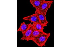 Immunofluorescence analysis of Hela cells using TOP2A mouse mAb.