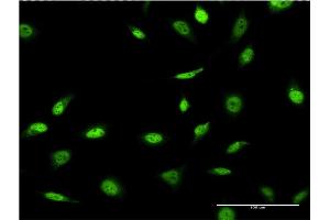 Immunofluorescence of monoclonal antibody to SNAPC4 on HeLa cell.