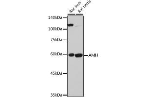Western blot analysis of extracts of various cell lines, using AMH antibody (ABIN7265629) at 1:500 dilution. (AMH anticorps  (AA 20-280))