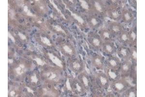 DAB staining on IHC-P; Samples: Rat Kidney Tissue (Rhotekin anticorps  (AA 296-548))