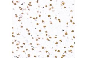 Immunohistochemistry of paraffin embedded mouse brain using Top2 (ABIN7075937) at dilution of 1:600 (400x lens)
