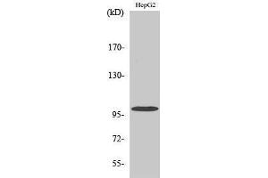 Western Blotting (WB) image for anti-Vav 2 Guanine Nucleotide Exchange Factor (VAV2) (Tyr299) antibody (ABIN3177911) (VAV2 anticorps  (Tyr299))