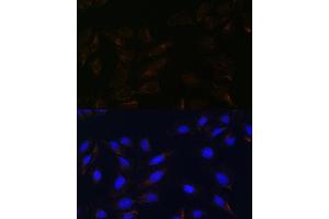 Immunofluorescence analysis of U-2 OS cells using IL13R antibody (ABIN7267987) at dilution of 1:100. (IL13RA2 anticorps)