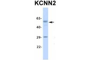 Host:  Rabbit  Target Name:  KCNN2  Sample Type:  Human Fetal Lung  Antibody Dilution:  1. (KCNN2 anticorps  (Middle Region))