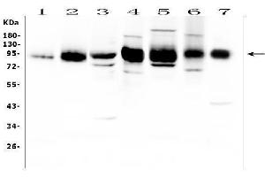Western blot analysis of ICAM1 using anti-ICAM1 antibody (ABIN5692991). (ICAM1 anticorps  (AA 28-268))