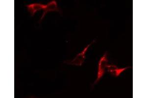 ABIN6279097 staining COLO205 by IF/ICC.