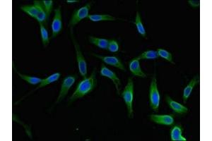Immunofluorescent analysis of Hela cells using ABIN7175942 at dilution of 1:100 and Alexa Fluor 488-congugated AffiniPure Goat Anti-Rabbit IgG(H+L)