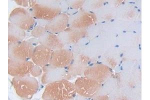 Detection of IL2 in Mouse Skeletal muscle Tissue using Polyclonal Antibody to Interleukin 2 (IL2) (IL-2 anticorps  (AA 10-169))