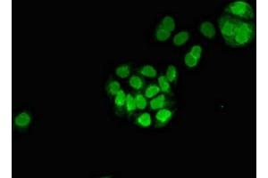 Immunofluorescent analysis of PC-3 cells using ABIN7159730 at dilution of 1:100 and Alexa Fluor 488-congugated AffiniPure Goat Anti-Rabbit IgG(H+L)
