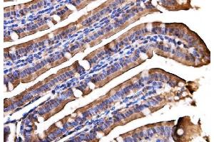 IHC analysis of AGPAT2 using anti-AGPAT2 antibody (ABIN7602435).