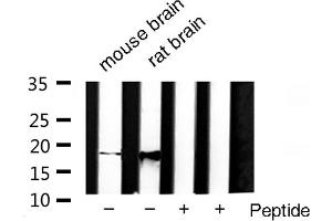 Western blot analysis of SOD1 Antibody expression in rat brain and mouse brain tissues lysates.