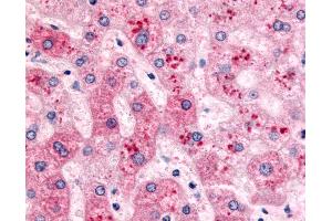 Anti-PYGL antibody IHC of human liver.