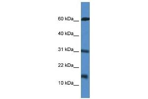 Western Blot showing CARD17 antibody used at a concentration of 1 ug/ml against Jurkat Cell Lysate (CARD17 anticorps  (Middle Region))