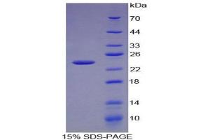 SDS-PAGE (SDS) image for Chemokine (C-X-C Motif) Ligand 15 (CXCL15) (AA 26-167) protein (His tag) (ABIN1170061)