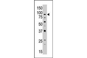 The ABCB7 polyclonal antibody  is used in Western blot to detect ABCB7 in Jurkat cell lysate. (ABCB7 anticorps  (C-Term))