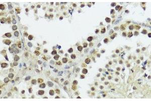 Immunohistochemistry of paraffin-embedded Mouse testis using Phospho-Histone H3(T11) Polyclonal Antibody at dilution of 1:100 (40x lens).