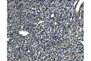 IHC analysis of ATP6V1A using anti-ATP6V1A antibody (ABIN7599916).