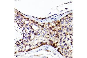 Immunohistochemistry of paraffin-embedded Human testis using S antibody (ABIN7270138) at dilution of 1:200 (40x lens).