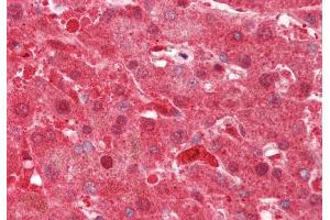 Rabbit Anti-DHODH antibody Catalog Number: ARP41939 Formalin Fixed Paraffin Embedded Tissue: Human Liver Primary antibody Concentration: 1:100 Secondary Antibody: Donkey anti-Rabbit-Cy3 Secondary Antibody Concentration: 1:200 Magnification: 20x Exposure Time: 0.