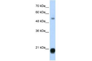 WB Suggested Anti-CBX3 Antibody Titration:  1. (CBX3 anticorps  (Middle Region))