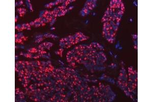 IF analysis of hnRNP U/p120/HNRNPU using anti-hnRNP U/p120/HNRNPU antibody (ABIN7600979).