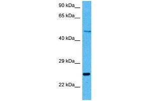 Host:  Mouse  Target Name:  PAX6  Sample Tissue:  Mouse Kidney  Antibody Dilution:  1ug/ml (PAX6 anticorps  (N-Term))