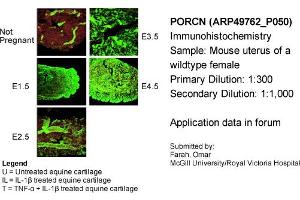Immunohistochemistry (IHC) image for anti-Porcupine Homolog (PORCN) (N-Term) antibody (ABIN2783888) (PORCN anticorps  (N-Term))