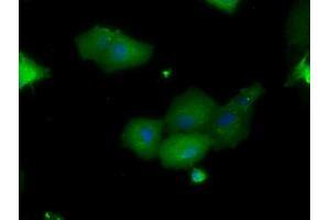 Image no. 4 for anti-Proto-Oncogene Pim-2 (Serine Threonine Kinase) (PIM2) antibody (ABIN1500220)