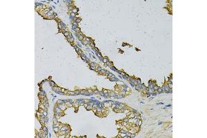 Immunohistochemistry of paraffin-embedded human prostate using RPLP0 Antibody (ABIN6290910) at dilution of 1:100 (40x lens). (RPLP0 anticorps)