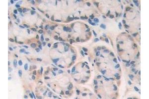 Detection of PARP in Mouse Intestine Tissue using Polyclonal Antibody to Poly ADP Ribose Polymerase (PARP)