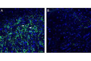 Expression of Neuroligin-3 in rat deep cerebellar nuclei.