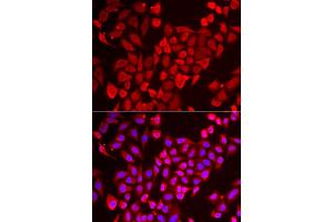 Immunofluorescence analysis of U2OS cell using TNP2 antibody.
