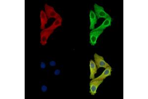 ABIN7097117 and ABIN7101184 staining Hela cells by IF/ICC. (RG9MTD1 anticorps)