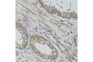 Immunohistochemistry of paraffin-embedded human prostate using PDCD6IP antibody. (ALIX anticorps  (AA 1-180))