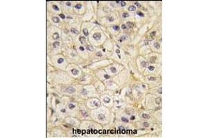 anti-G Protein-Coupled Receptor Kinase 1 (GRK1) (AA 520-550), (C-Term) antibody