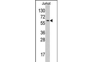Western blot analysis of YARS polyclonal antibody  in Jurkat cell line lysates (35 ug/lane). (YARS anticorps  (N-Term))