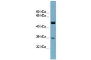 Image no. 1 for anti-RAB27A, Member RAS Oncogene Family (RAB27A) (C-Term) antibody (ABIN6741985) (RAB27A anticorps  (C-Term))