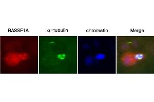 Immunocytochemistry: A431 cells were labeled with anti-RASSF1a(clone 3F3) mAb, and detection was using a biotinylated secondary antibody and Texas-red conj.